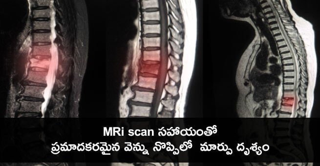 diagnose-facet-joint-arthropathy diagnose-facet-joint-arthropathy