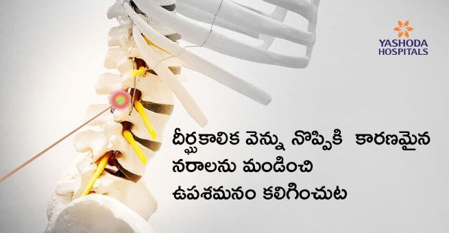treatment-for-facet-arthropathy treatment-for-facet-arthropathy