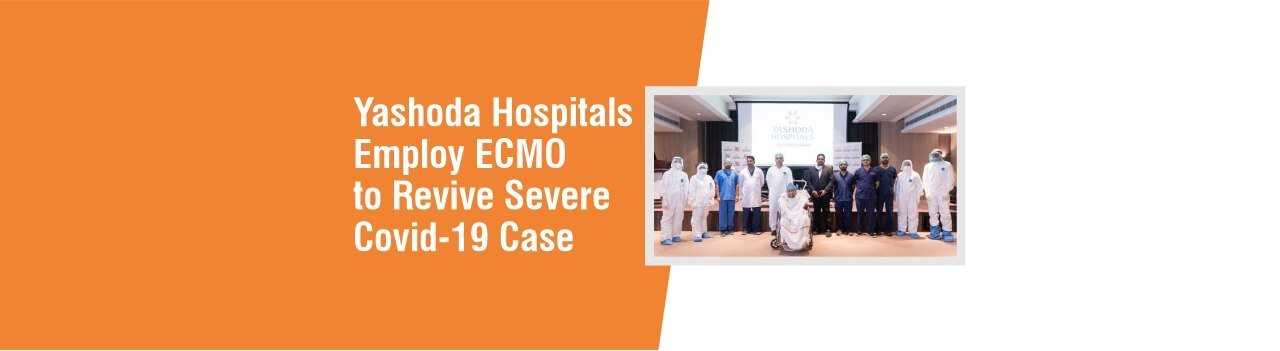 یشودا ہسپتال شدید کووڈ کو بحال کرنے کے لیے ECMO کا استعمال کرتے ہیں۔