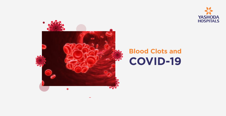 রক্ত জমাট বাঁধা এবং COVID-19