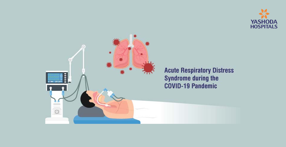 Acute Respiratory Distress Syndrome during the COVID-19 Pandemic