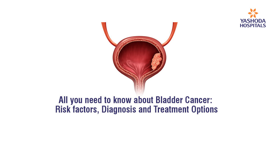 All you need to know about Bladder Cancer: Risk factors, Diagnosis and Treatment Options