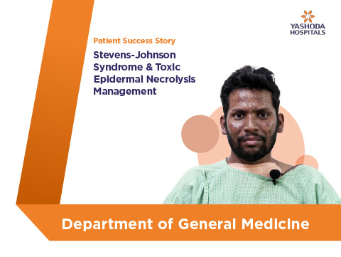 Sindrom Stevens-Johnson dan Pengurusan Nekrolisis Epidermis Toksik