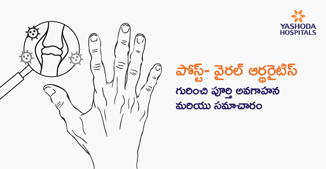 Viral Arthritis Telugu Banner