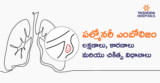 Pulmonary embolism telugu banner