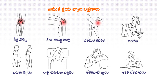 bone tuberculosis symptoms