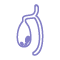 Gallbladder Stone