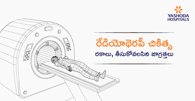 Radiotherapy treatment Telugu_Main Banner