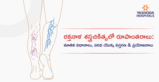 రక్తనాళ శస్త్రచికిత్సలో రూపాంతరఁాలన: విధానాలు, పరిధి యొక్క విస్తరణ & ব্যভি