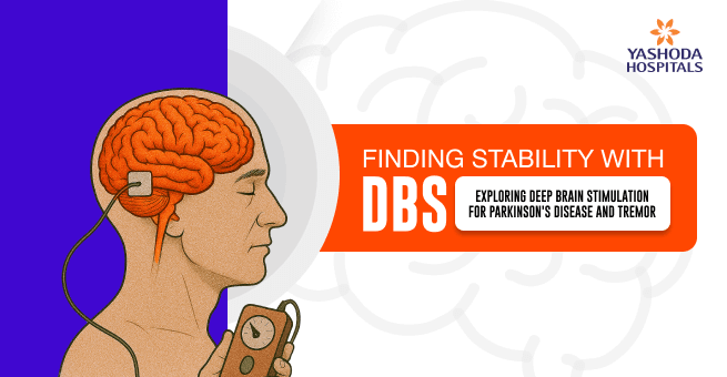 Finding Stability with DBS: Exploring Deep Brain Stimulation for Parkinson’s Disease and Tremor