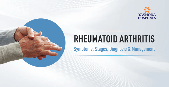 Rheumatoid arthritis main Banner