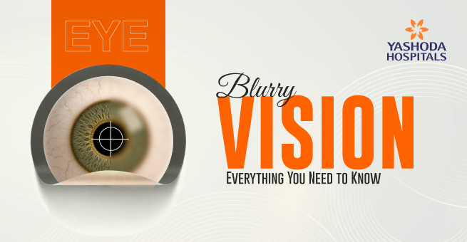 Blurry Vision: Everything You Need to Know