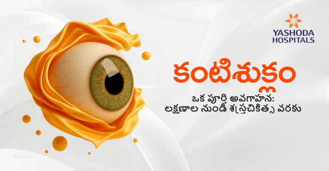 కంటిశుక్లం – ఒక పూర్తి అవగాహన: లక్షణాల నుండి శస్త్రచికిత్స వరకు