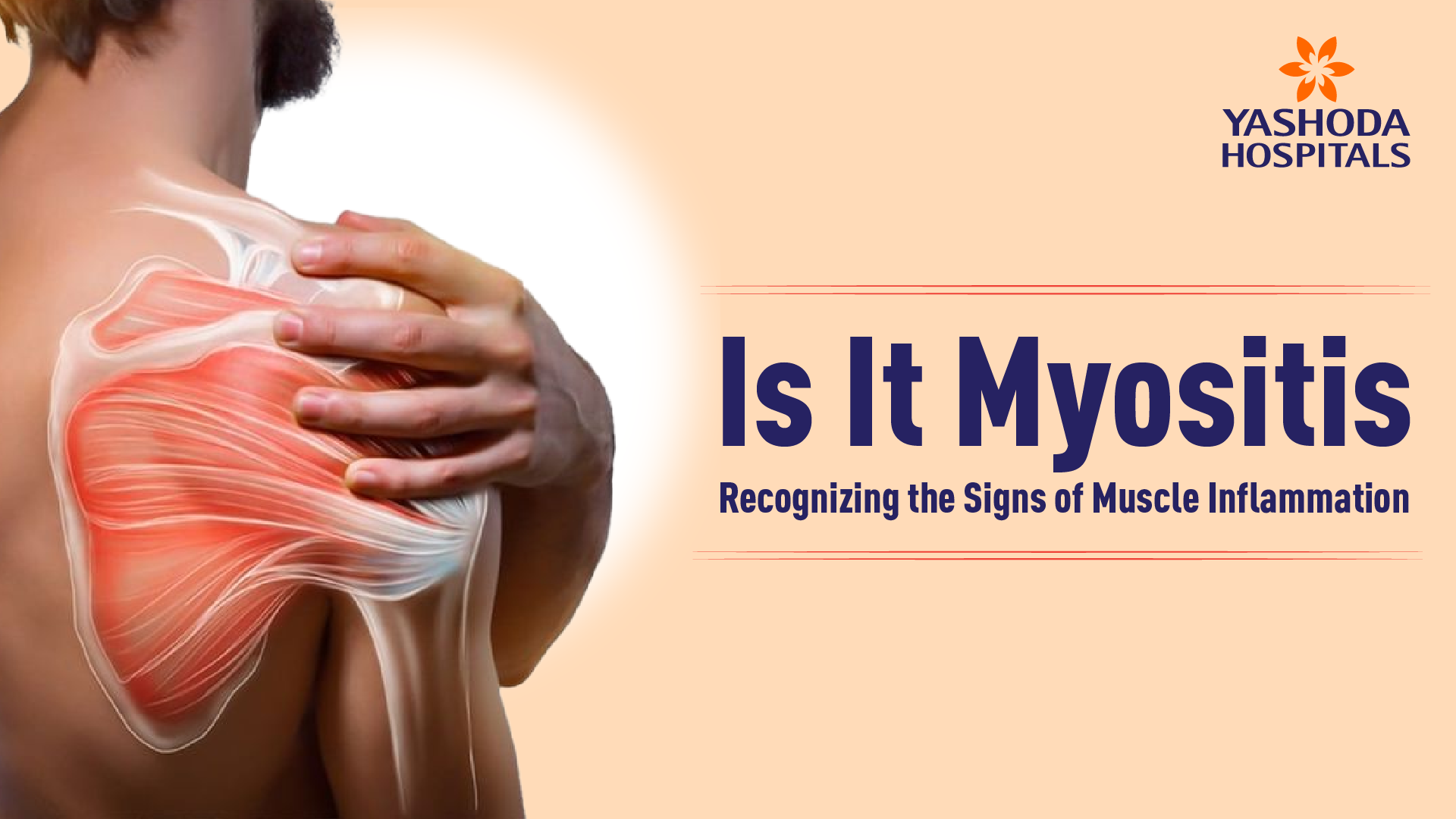 Is It Myositis