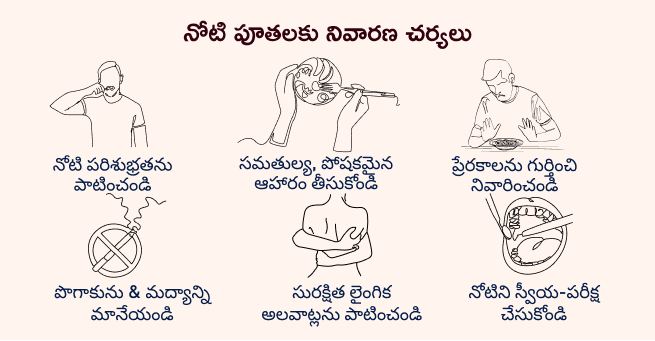 Mouth ulcers-2