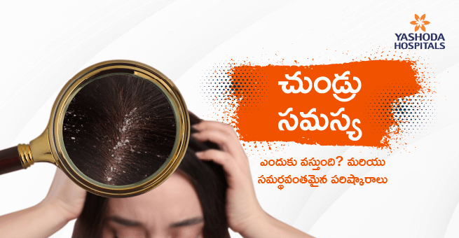 చుండ్రు సమస్య : ఎందుకు వస్తుంది? మరియు సమర్థవంతమైన పరిష్కారాలు