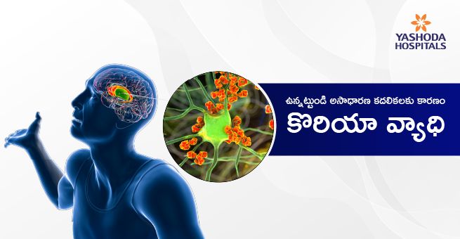 chorea-disease-main