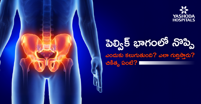 పెల్విక్ భాగంలో నొప్పి ఎందుకు కలుఁిక్? ఎలా గుర్తిస్తారు؟ చికిత్స ఏంటి?