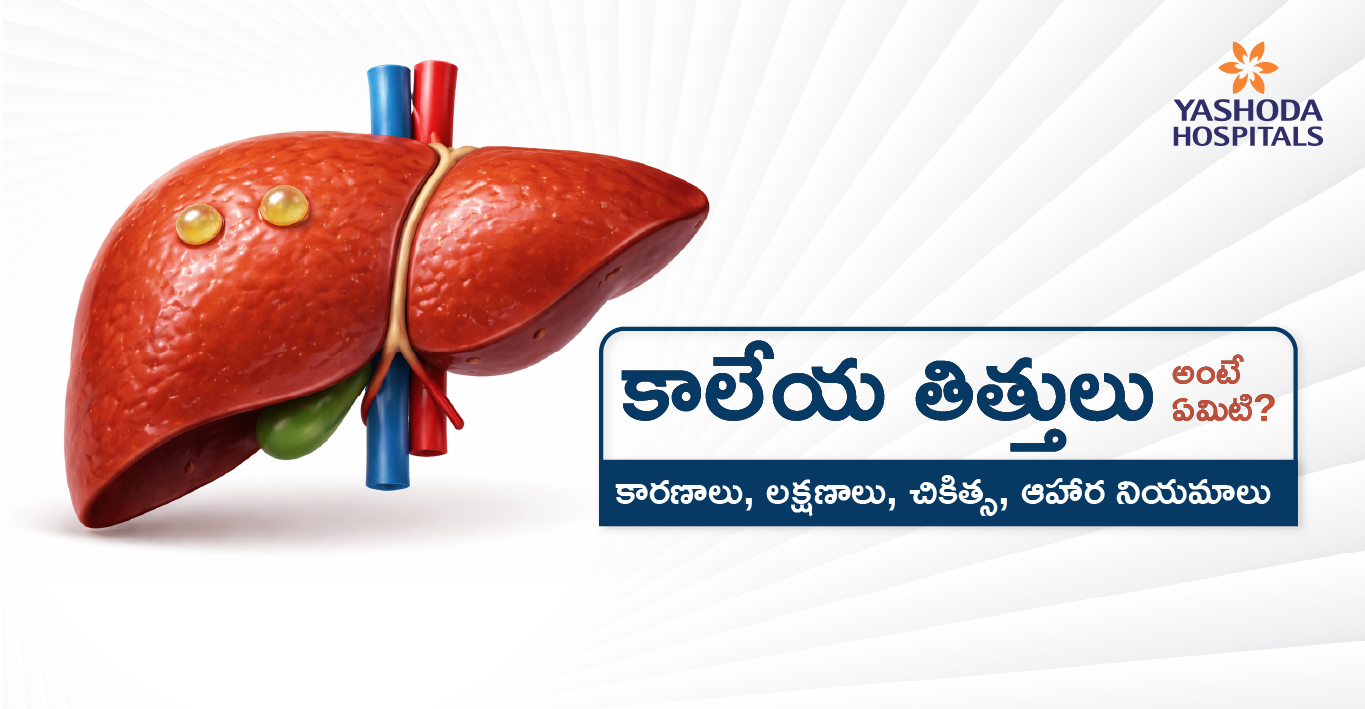 కాలేయ తిత్తులు అంటే ఏమిటి? కారణాలు၊ లక్షణాలు၊ చికిత్స၊