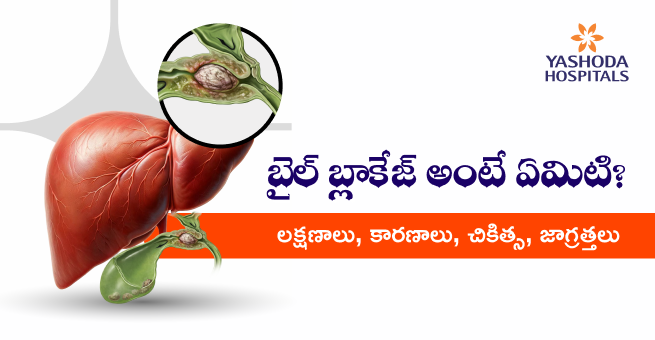 బైల్ బ్లాకేజ్ అంటే ఏమిటి? లక్షణాలు၊ కారణాలు၊