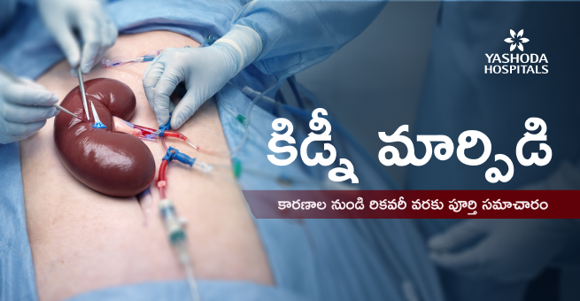 kidney-transplant