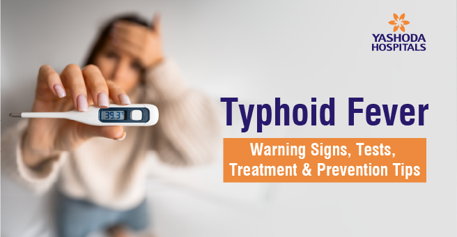 typhoid-fever