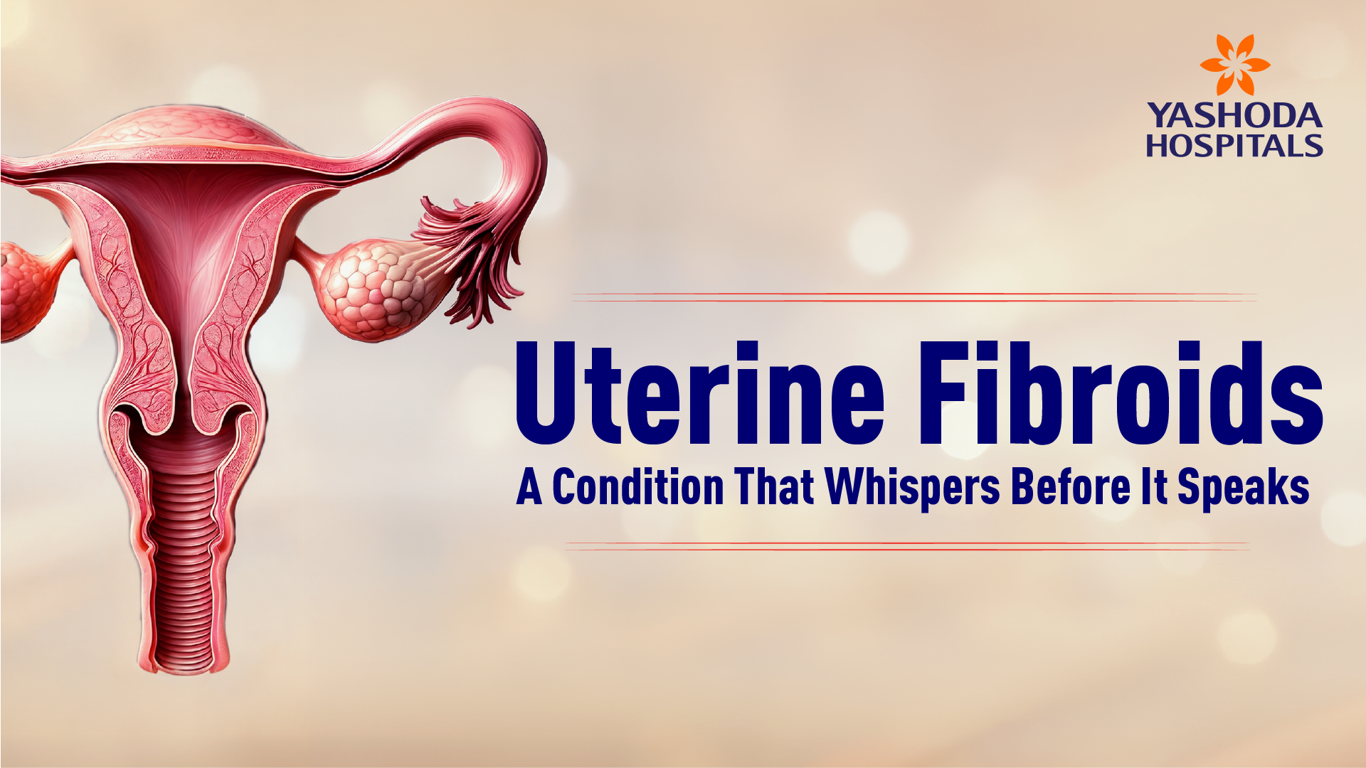 Uterine Fibroids: علامات، وجوہات، تشخیص اور علاج کے اختیارات