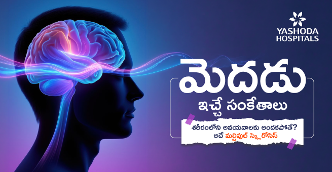 Multiple Sclerosis