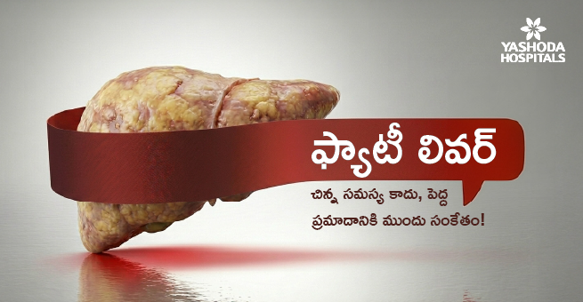 ఫ్యాటీ లివర్ : చిన్న సమస్య కాదు၊ పెద్ద ప్రమాదానికి ముందు సంకేతం!