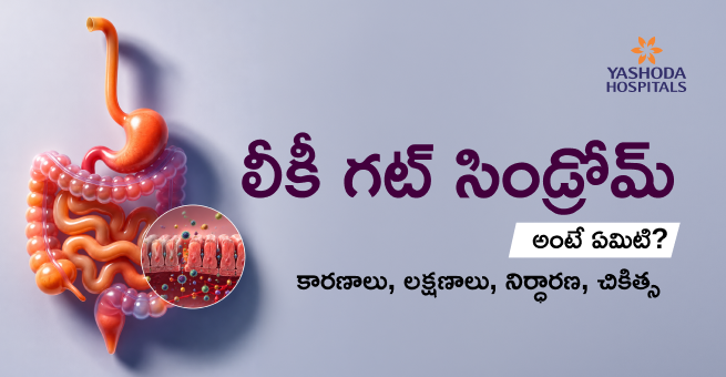 లీకీ గట్ సిండ్రోమ్ అంటే ఏమిట। కారణాలు၊ లక్షణాలు၊ నిర్ధారణ၊