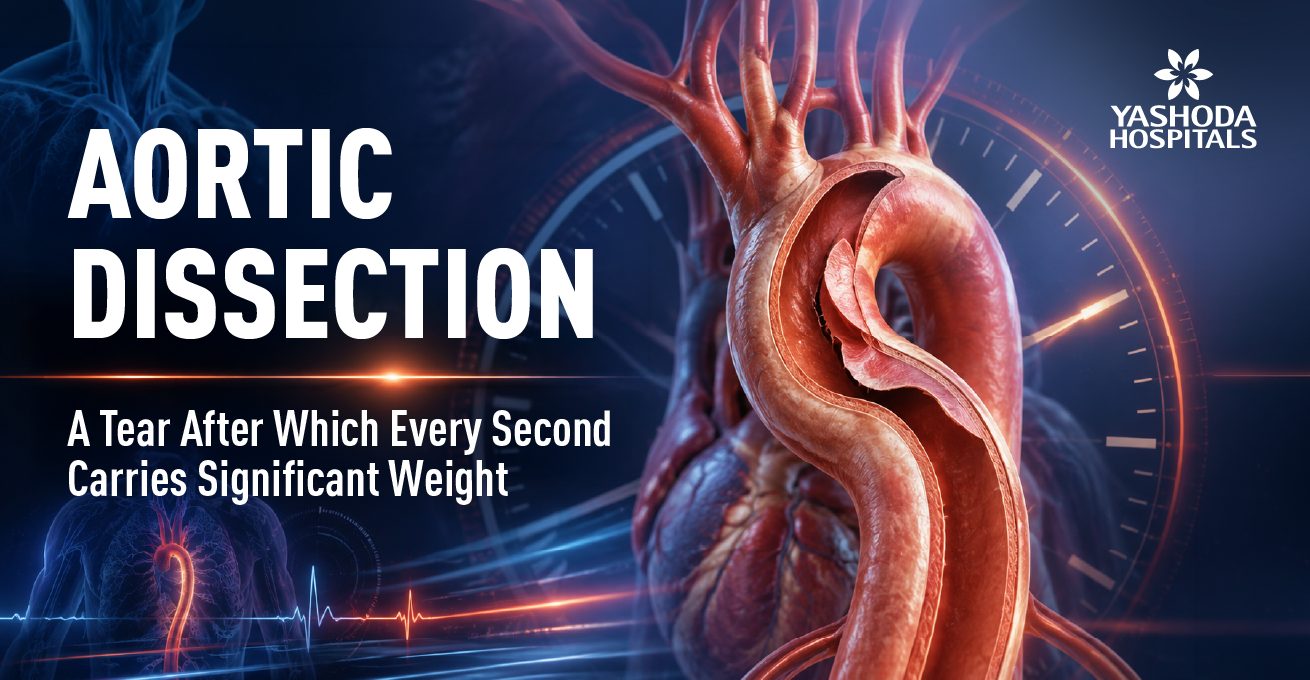 AORTIC DISSECTION