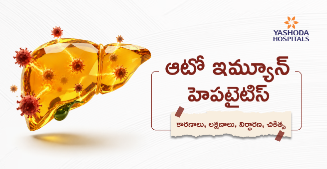 ఆటో ఇమ్యూన్ హెపటైటిస్ : కారణాలు၊ లకౣషు నిర్ధారణ၊