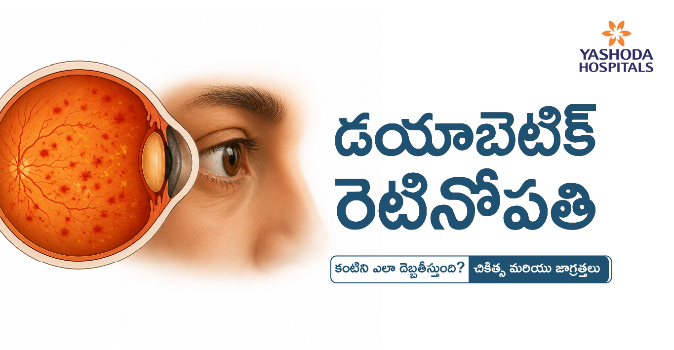 Diabetic-Retinopathy