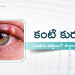 Eye ulcers