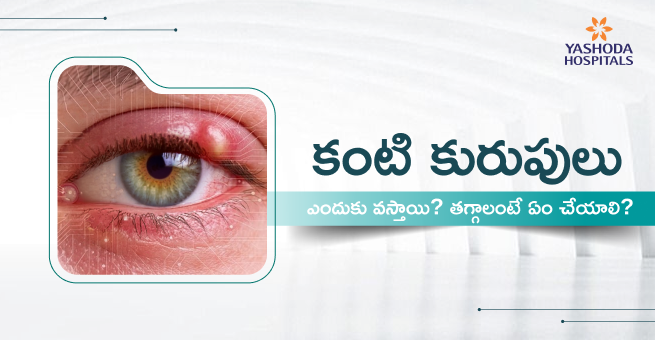 Eye ulcers