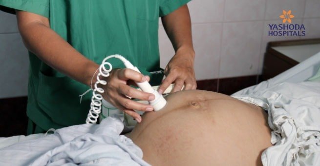 Transvaginal ultrasound