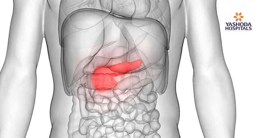 pancreatic cancer (PC) pancreatic cancer (PC)
