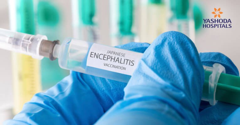 Encephalitis-brain fever outbreak Encephalitis-brain fever outbreak