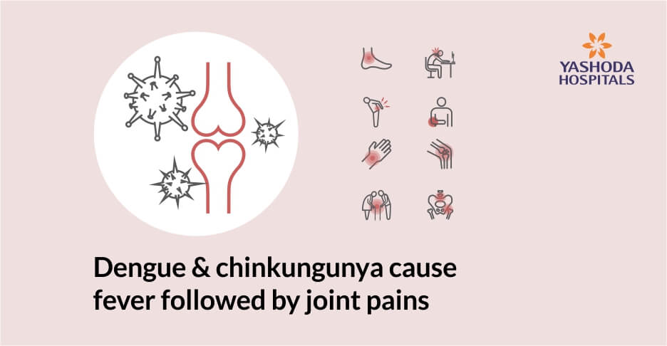 What are the viruses that can cause an arthritis? What are the viruses that can cause an arthritis?